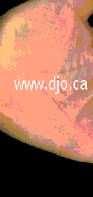 web dom@in www.djo.ca opens in new window